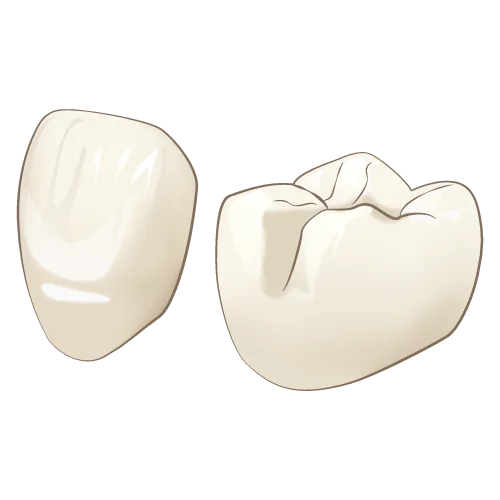 宝塚でオールセラミックを使用した審美歯科治療なら安福歯科医院