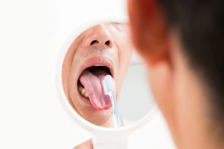 舌ブラシで口臭予防