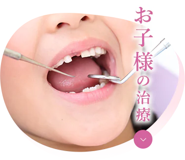 宝塚市の安福歯科医院のお子様の歯科治療