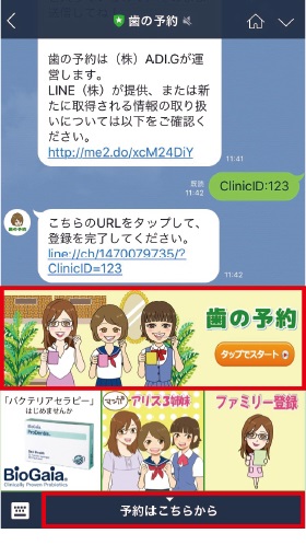 歯の予約を起動